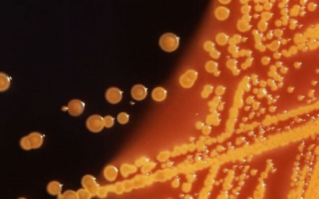 Antibiotics crisis and phage therapy as the answer