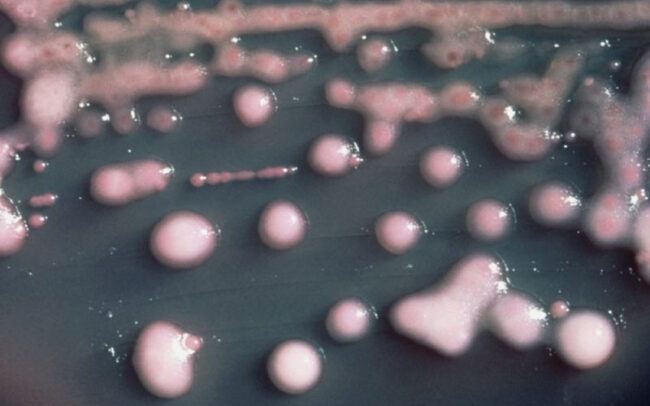 Superbug resistant to all antibiotics - phage therapy alternative