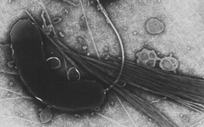 Bacteriophages used to cure cholera infection