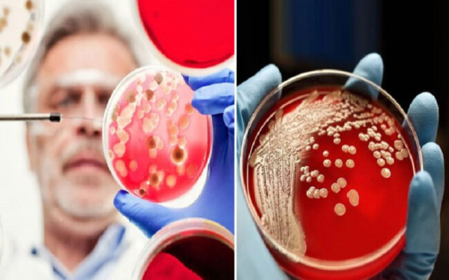 Superbugs as rising threat - phage therapy solutions