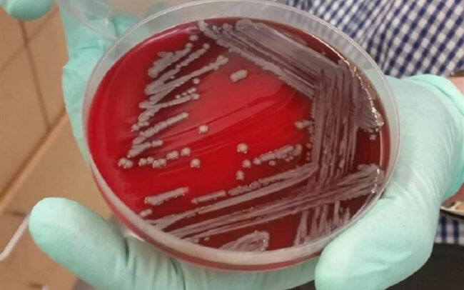 Houston superbug warning - phage therapy alternative