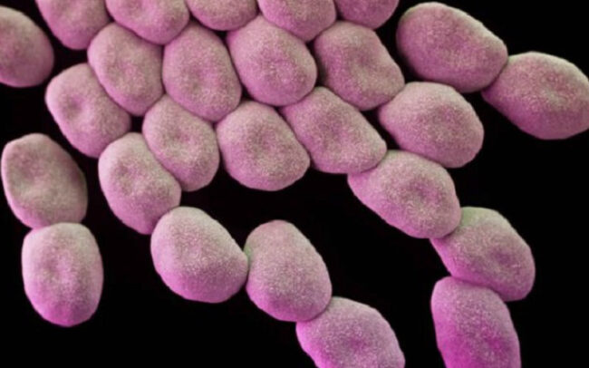 Superbug C. auris identified across 7 US states