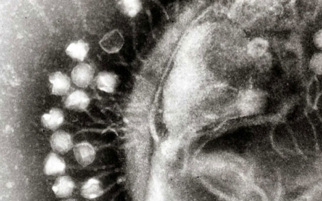 Century-old viruses as best defense against antibiotic resistance