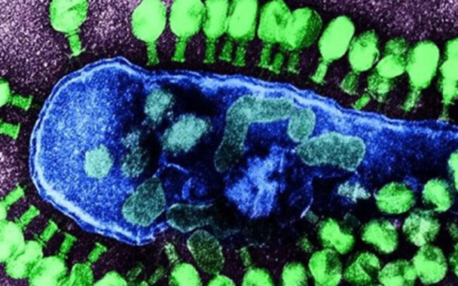 FDA clears clinical studies for new bacteriophage treatment
