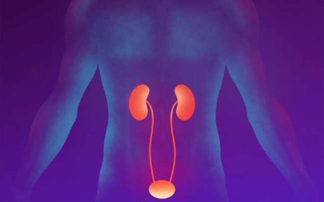 Cystitis treatment with phage therapy at Eliava Center